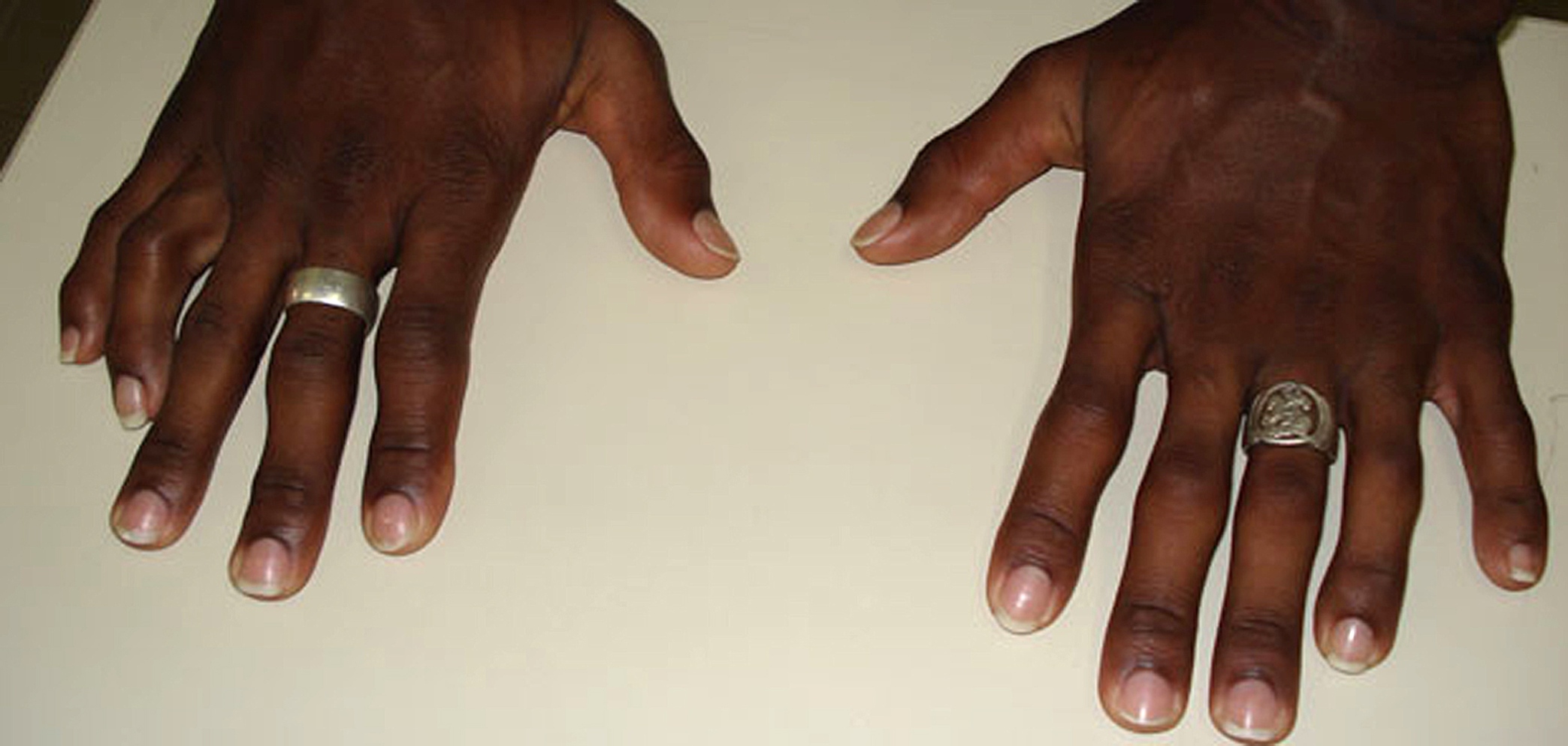 hands