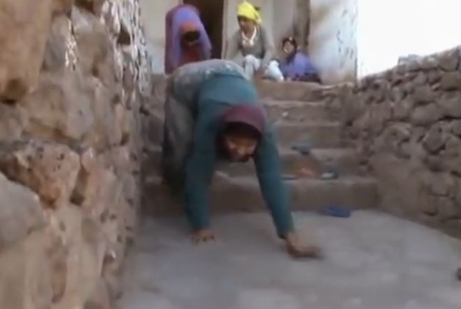 Family disability means they walk on all fours - Emirates 24|7