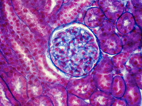 kidney
